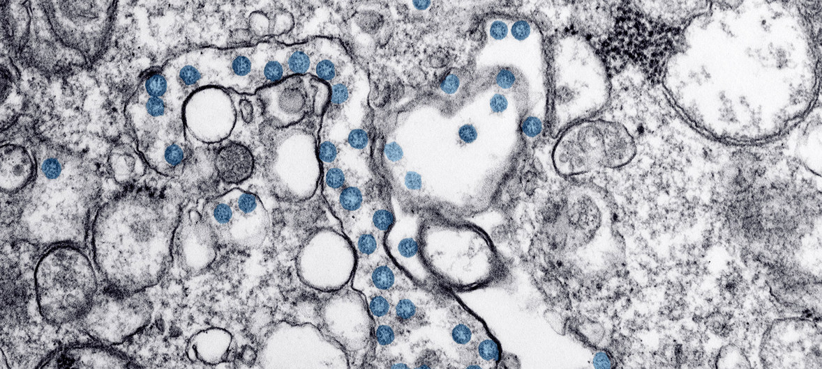 El coronavirus COVID-19 es una pandemia